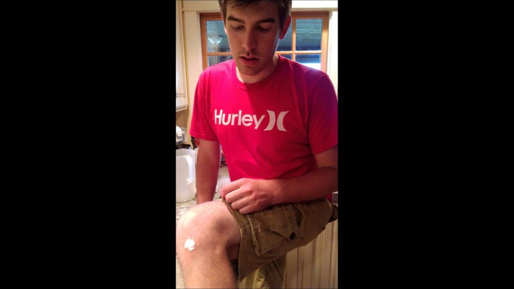 Treat Bee Stings Quickly and Effectively