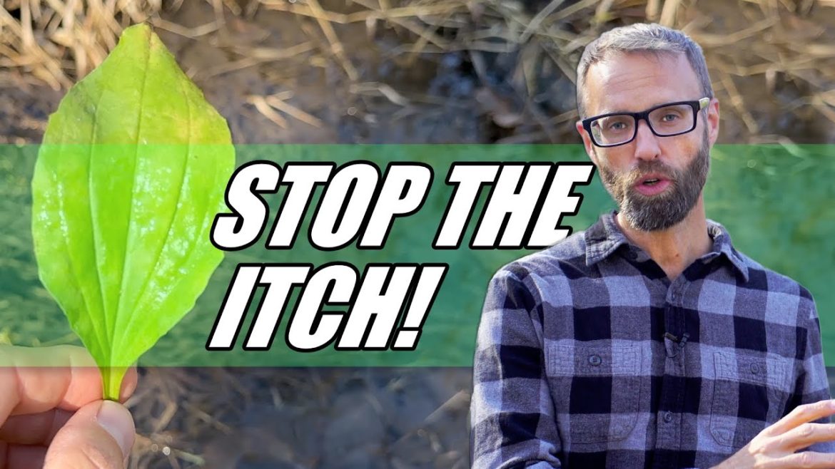 How to stop the itch from POISON IVY, CHIGGERS, potentially ECZEMA and Bee Stings! Natural Remedy How to stop the itch from POISON IVY, CHIGGERS, potentially ECZEMA and Bee Stings! Natural Remedy