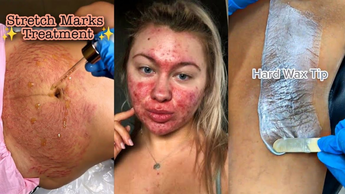 TikTok Beauty Hacks & Tips | Hygiene Tips Every Girl Must Know πβ¨ TikTok Beauty Hacks & Tips | Hygiene Tips Every Girl Must Know πβ¨