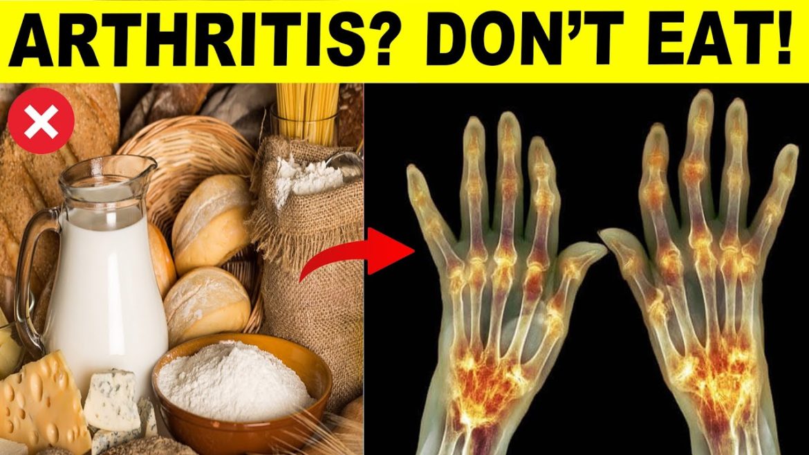 9 Foods To Avoid If You Have Arthritis 9 Foods To Avoid If You Have Arthritis