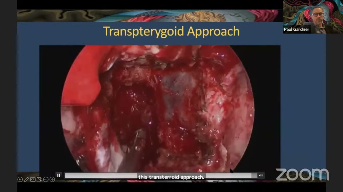 The Modern Paradigm for Skull Base Surgery/Dr. Paul Gardner, MD