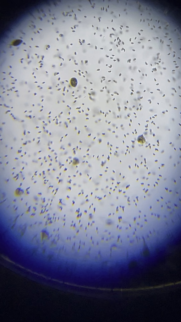 Close up look at some of the very small life inside my 2.5 gallon minnow ecosphere