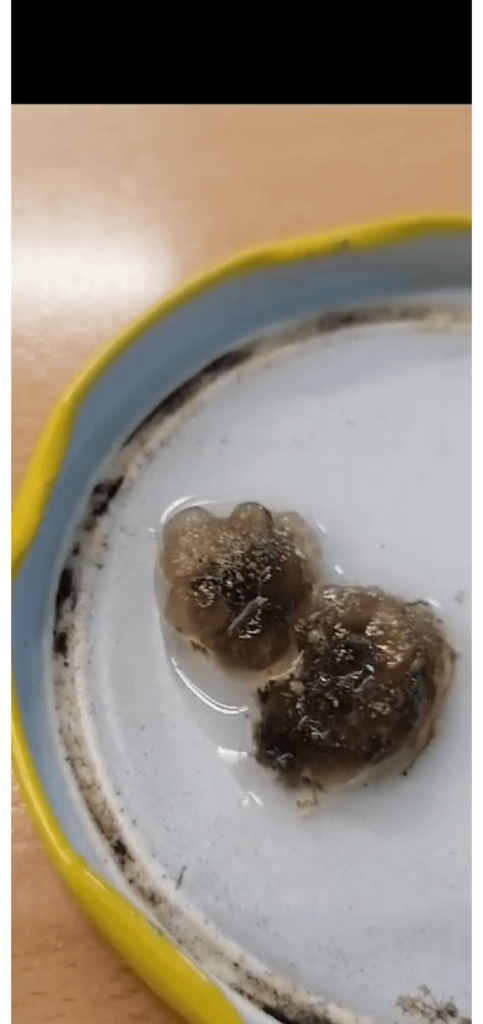 Jelly balls