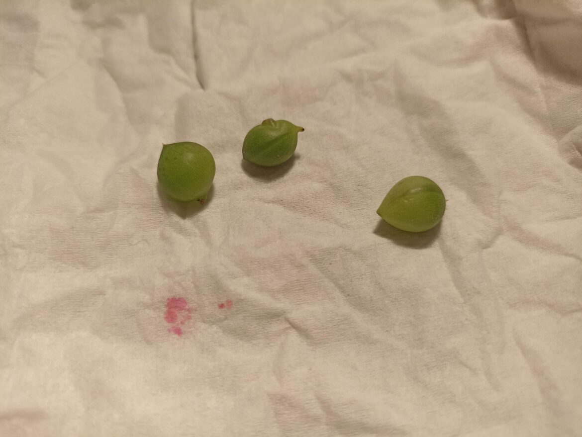 Can those be propped from just a single pearl?