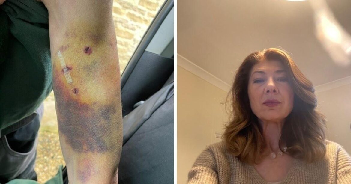 Cirencester gardener attacked by Rhodesian Ridgeback dog Cotswolds gardener attacked by Rhodesian Ridgeback dog