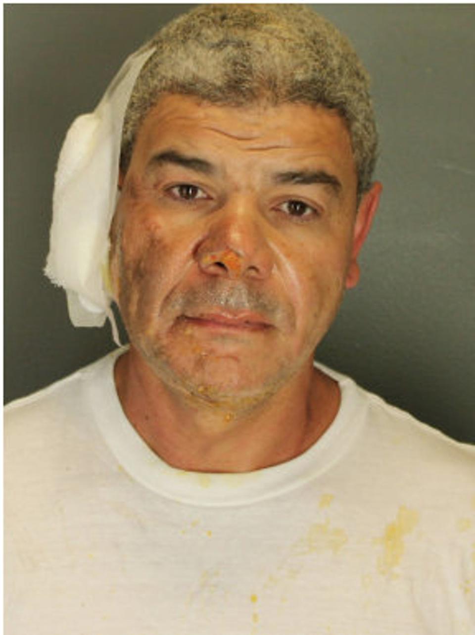 An arrest mugshot appeared to show Soliman with burns to his face and his right ear bandaged. He sustained injuries to his hands and was taken to a local hospital for treatment after his arrest, according to police (Boulder PD)