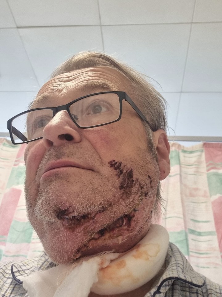 Close-up of a man's neck wound.