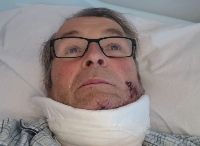 COLLECT - Christopher when treated in Chesterfield Hospital. Christopher York, 65, from Chesterfield who accidentally cut his neck open with a chainsaw. June 27, 2025. A man who suffered 