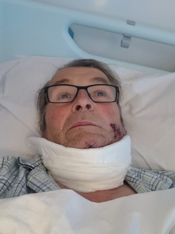 COLLECT - Christopher when treated in Chesterfield Hospital. Christopher York, 65, from Chesterfield who accidentally cut his neck open with a chainsaw. June 27, 2025. A man who suffered "catastrophic blood loss" when he accidentally cut his neck open with a chainsaw while gardening has recalled a series of fortunate events that led to his survival. Christopher York was in his garden in Chesterfield, Derbyshire, when the chainsaw he was using became jammed, while cutting left to right, before it then followed through a branch and then "span around". The 65-year-old said he then felt a "cold wetness" at his front and saw his blood-covered shirt. Christopher said a number of coincidences, including a specialist vascular surgeon being on duty at the hospital he was rushed to who then operated on him, meant he lived, and has thanked NHS staff who helped him.