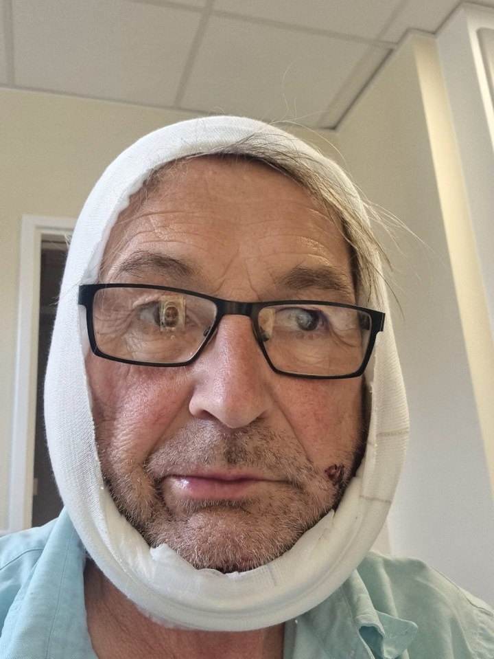 COLLECT - Christopher when treated in Chesterfield Hospital. Christopher York, 65, from Chesterfield who accidentally cut his neck open with a chainsaw. June 27, 2025. A man who suffered "catastrophic blood loss" when he accidentally cut his neck open with a chainsaw while gardening has recalled a series of fortunate events that led to his survival. Christopher York was in his garden in Chesterfield, Derbyshire, when the chainsaw he was using became jammed, while cutting left to right, before it then followed through a branch and then "span around". The 65-year-old said he then felt a "cold wetness" at his front and saw his blood-covered shirt. Christopher said a number of coincidences, including a specialist vascular surgeon being on duty at the hospital he was rushed to who then operated on him, meant he lived, and has thanked NHS staff who helped him.