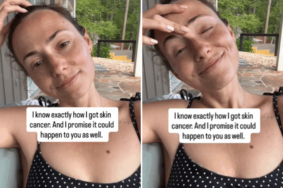 Millennial Spent the Summer Gardening in Yard, Then Came Shocking Diagnosis Skin cancer story