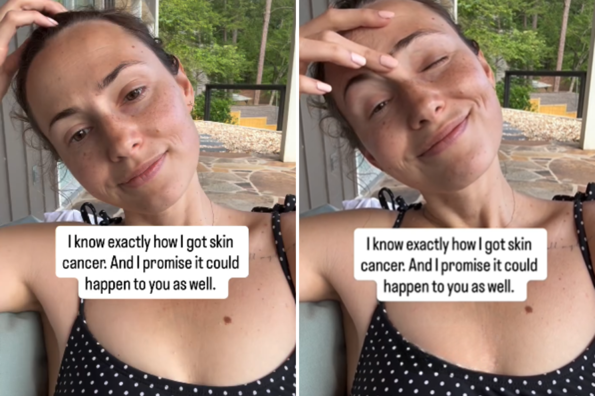 Skin cancer story