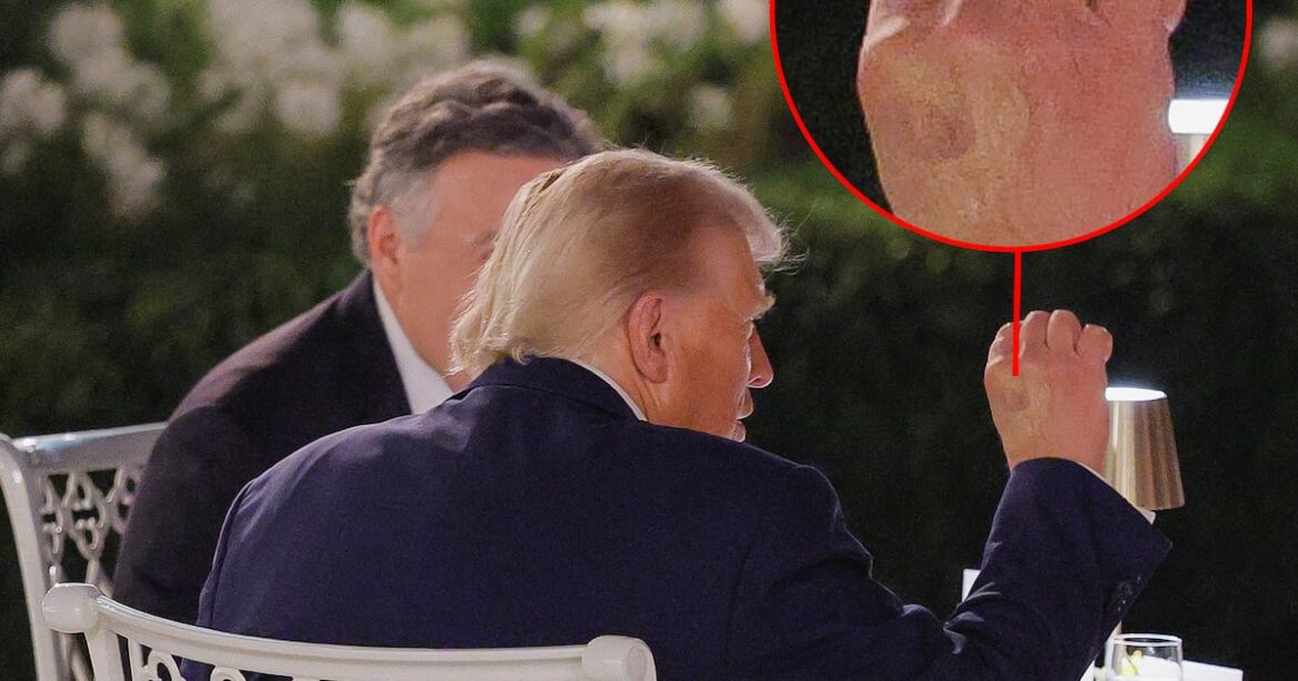 Donald Trump’s Makeup-Slathered Hand Makes Appearance at Rose Garden Dinner