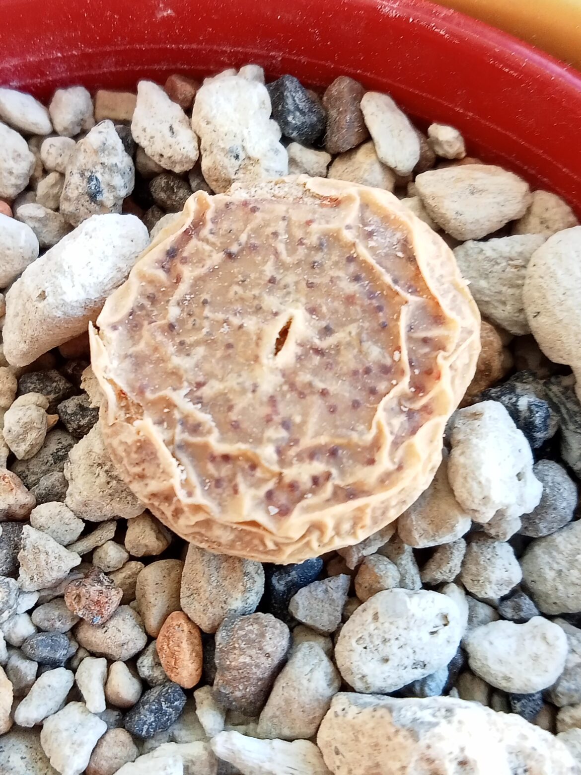 What's wrong with my butt?