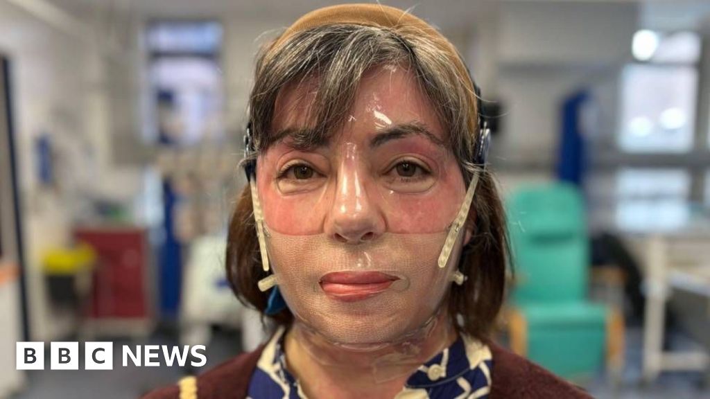 Llanelli woman severely injured after garden bonfire explodes Llanelli woman severely injured after garden bonfire explodes