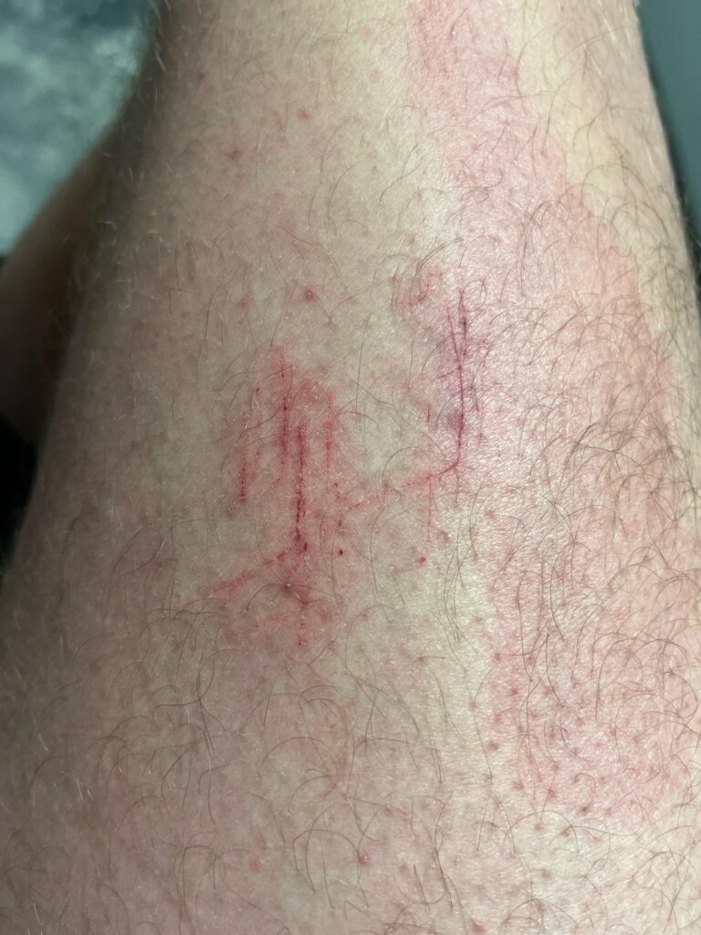 Tripped really hard on my San Pedro cactus last night.