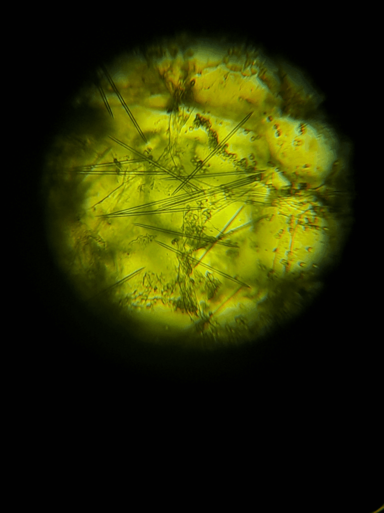 needles under microscope