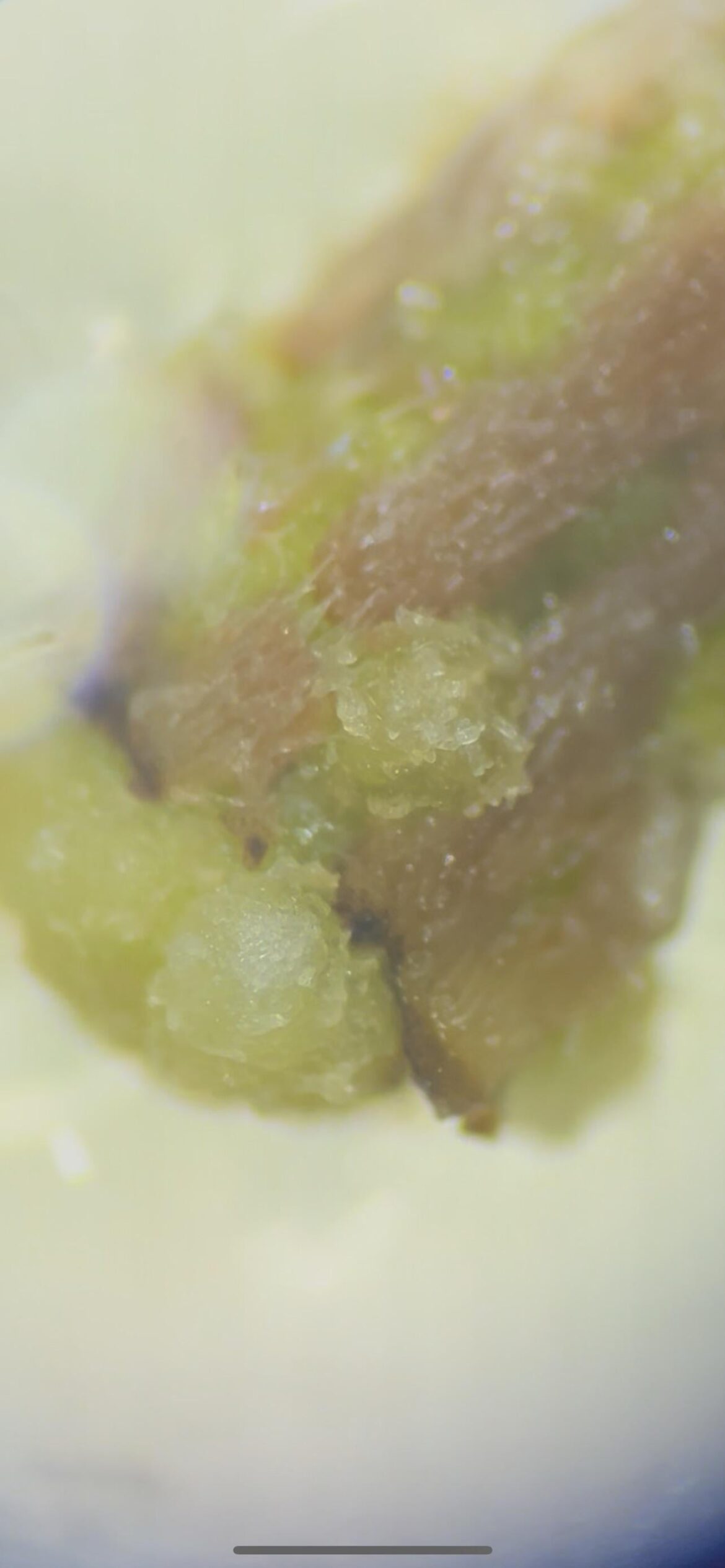 Does this look like a early callus?