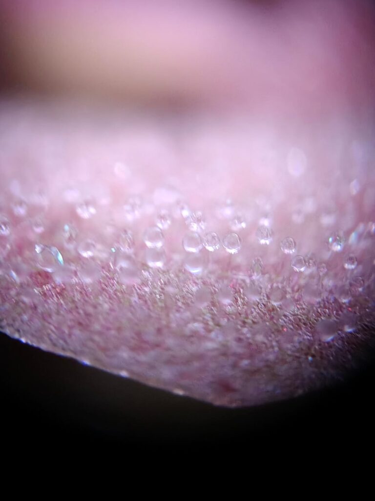 pings glue droplets, but extra magnified :D