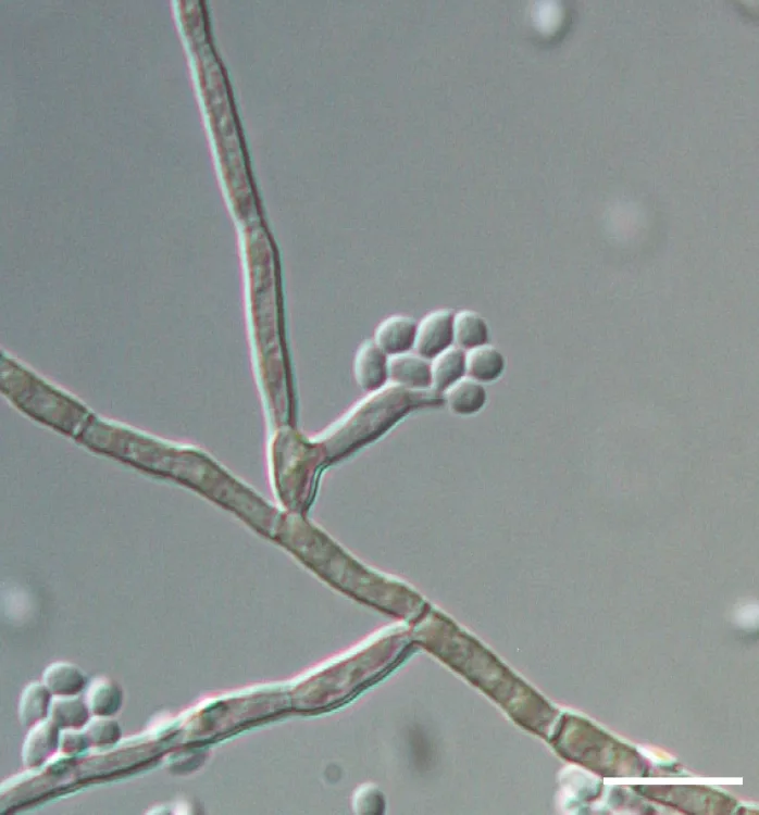 08. Magnaporthiopsis stipae 01 - CREDIT - C.L. Zhang
