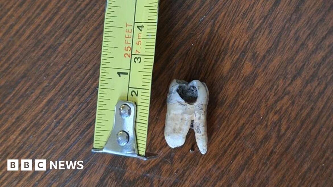 A tooth next to a yellow tape measure. It measures at about 2.5cm and is on a dark wooden table.