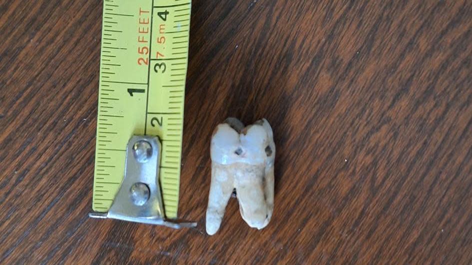 A tooth next to a yellow tape measure. It measures at about 2.5cm and is on a dark wooden table.
