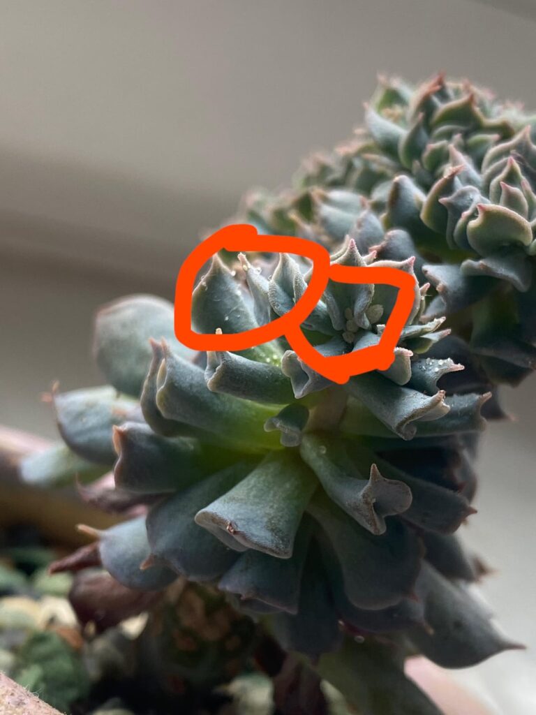 What’s this thing on my boyfriend’s succ What’s this thing on my boyfriend’s succ