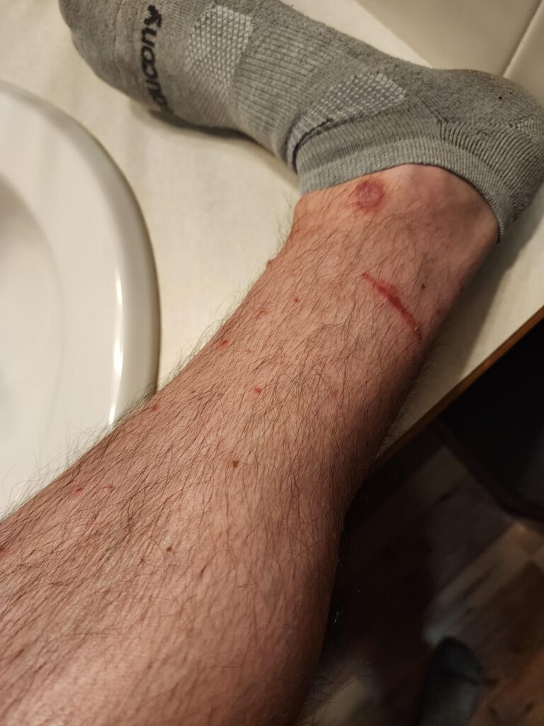 Just moved to East Kansas (Lawrence) area. Is this poison ivy? Just moved to East Kansas (Lawrence) area. Is this poison ivy?