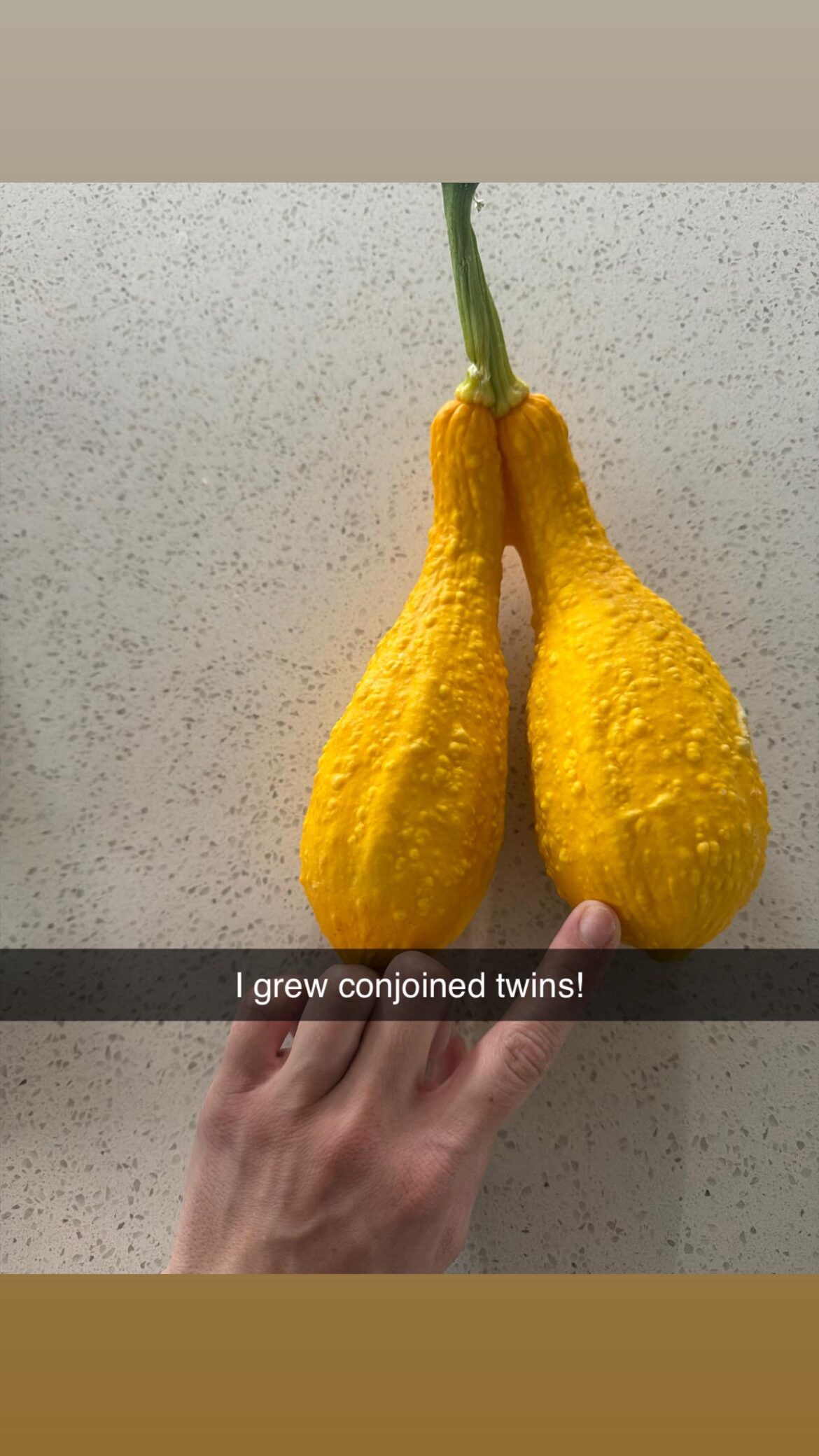Did I grow conjoined twins?!?!