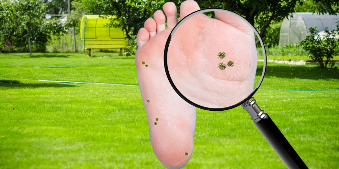 Backyard Bindii: How To Stop The Pricks